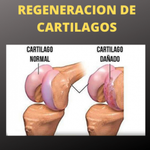 REGENERACION DE CARTILAGOS